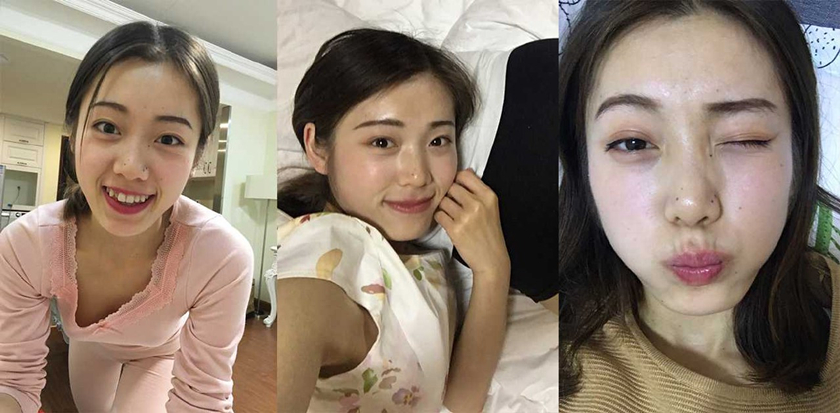 湖南 韩亚超 情侣私拍泄密 出轨怀孕奉子成婚 口交内射视频被绿帽男愤怒曝出！